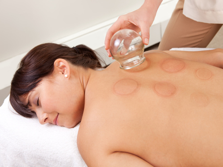 Cupping Massage