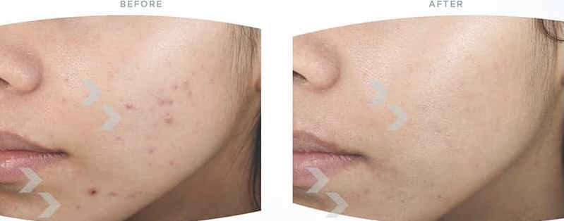 Ormedic-facial-clinical-results (1)